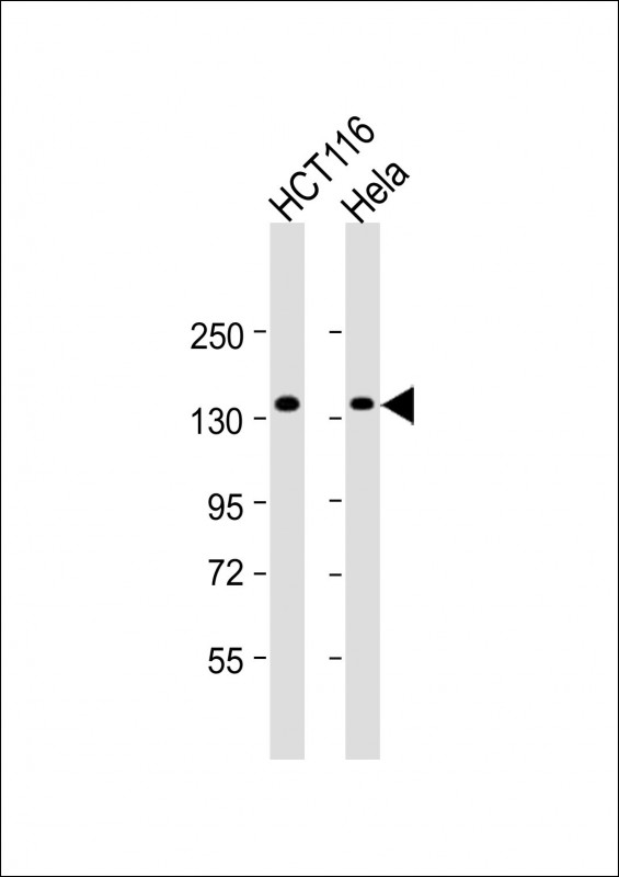 All lanes : Anti-ANKS1A Antibody (N-term) at 1:2000 dilutionLane 1: HCT116 whole cell lysateLane 2: Hela whole cell lysateLysates/proteins at 20 �g per lane. SecondaryGoat Anti-Rabbit IgG,  (H+L), Peroxidase conjugated at 1/10000 dilution. Predicted band size : 123 kDaBlocking/Dilution buffer: 5% NFDM/TBST.