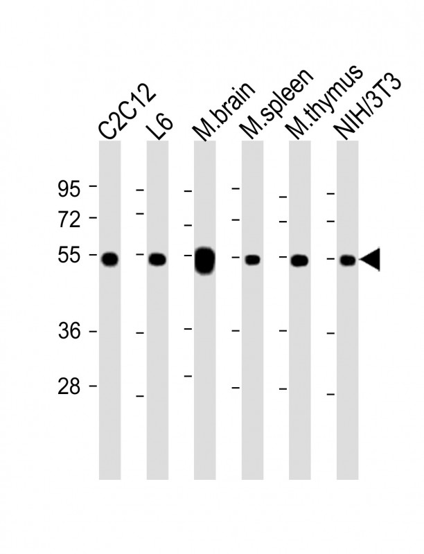 All lanes : Anti-beta Tubulin at 1:2000 dilutionLane 1: C2C12 whole cell lysateLane 2: L6 whole cell lysateLane 3: mouse brain lysateLane 4: mouse spleen whole cell lysateLane 5: mouse thymus lysateLane 6: NIH/3T3 whole cell lysateLysates/proteins at 20 �g per lane. SecondaryGoat Anti-Rabbit IgG,  (H+L), Peroxidase conjugated at 1/10000 dilution. Predicted band size : 50 kDaBlocking/Dilution buffer: 5% NFDM/TBST.