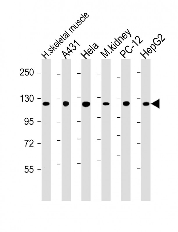 All lanes : Anti-Vinculin at 1:2000 dilutionLane 1: human skeletal muscle lysateLane 2: A431 whole cell lysateLane 3: Hela whole cell lysateLane 4: mouse kidney lysateLane 5: PC-12 whole cell lysateLane 6: HepG2 whole cell lysateLysates/proteins at 20 �g per lane. SecondaryGoat Anti-Rabbit IgG,  (H+L), Peroxidase conjugated at 1/10000 dilution. Predicted band size : 117 kDaBlocking/Dilution buffer: 5% NFDM/TBST.