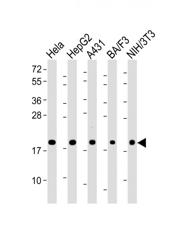 All lanes : Anti-Cyclophilin B Antibody at 1:2000 dilutionLane 1: Hela whole cell lysateLane 2: HepG2 whole cell lysateLane 3: A431 whole cell lysateLane 4: BA/F3 whole cell lysateLane 5: NIH/3T3 whole cell lysateLysates/proteins at 20 �g per lane.  SecondaryGoat Anti-Rabbit IgG,   (H+L),  Peroxidase conjugated at 1/10000 dilution.  Predicted band size : 24 kDaBlocking/Dilution buffer: 5% NFDM/TBST.