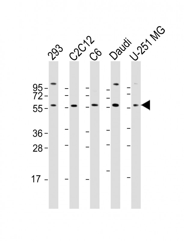 All lanes : Anti-YY1 Antibody (N-term) at 1:2000 dilutionLane 1: 293 whole cell lysateLane 2: C2C12 whole cell lysateLane 3: C6 whole cell lysateLane 4: Daudi whole cell lysateLane 5: U-251 MG whole cell lysateLysates/proteins at 20 �g per lane. SecondaryGoat Anti-Rabbit IgG,  (H+L), Peroxidase conjugated at 1/10000 dilution. Predicted band size : 45 kDaBlocking/Dilution buffer: 5% NFDM/TBST.