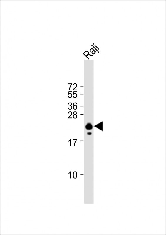 Anti-PRDX2 Antibody (Center) at 1:1000 dilution + Raji whole cell lysateLysates/proteins at 20 �g per lane. SecondaryGoat Anti-Rabbit IgG,  (H+L), Peroxidase conjugated at 1/10000 dilution. Predicted band size : 22 kDaBlocking/Dilution buffer: 5% NFDM/TBST.