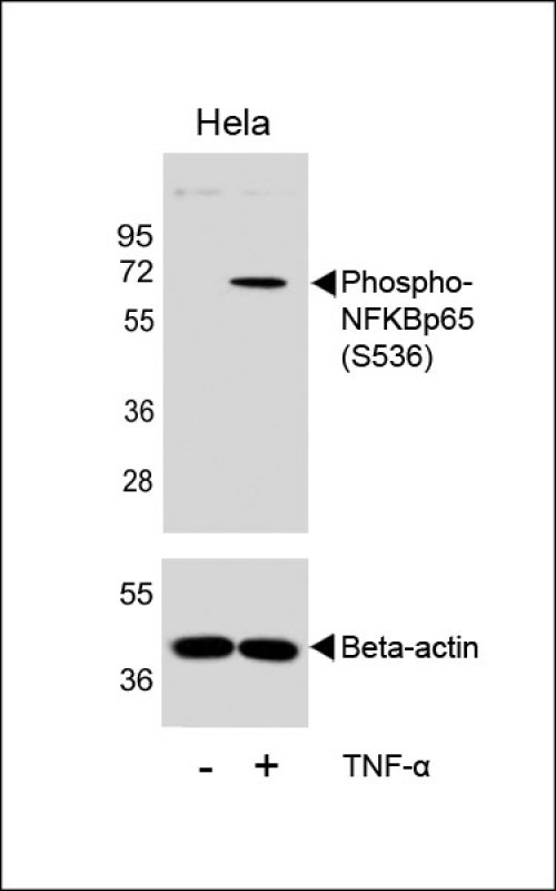 WB - Phospho-NFKB(S536) Antibody AP3178a