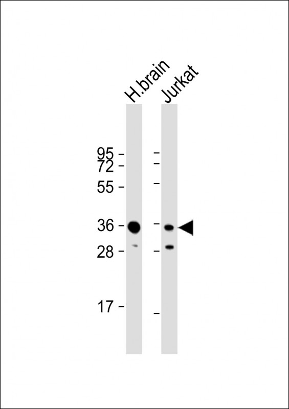 WB - GNB1 Antibody (N-term) AP5036a