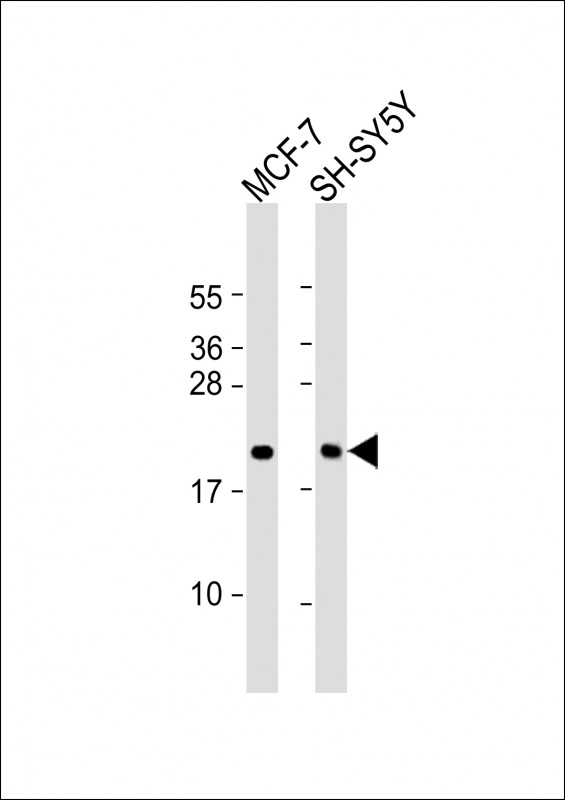 All lanes : Anti-BTG1 Antibody (Center) at 1:2000 dilutionLane 1: MCF-7 whole cell lysateLane 2: SH-SY5Y whole cell lysateLysates/proteins at 20 �g per lane.  SecondaryGoat Anti-Rabbit IgG,   (H+L),  Peroxidase conjugated at 1/10000 dilution.  Predicted band size : 19 kDaBlocking/Dilution buffer: 5% NFDM/TBST.
