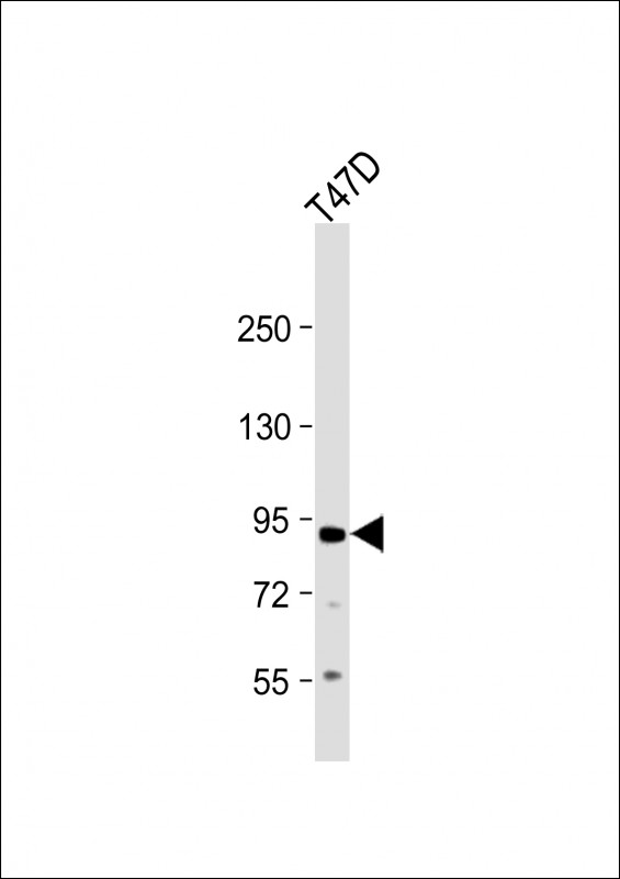 Anti-APP Antibody (C-term D672)  at 1:1000 dilution + T47D whole cell lysateLysates/proteins at 20 �g per lane. SecondaryGoat Anti-Rabbit IgG,  (H+L), Peroxidase conjugated at 1/10000 dilution. Predicted band size : 87 kDaBlocking/Dilution buffer: 5% NFDM/TBST.
