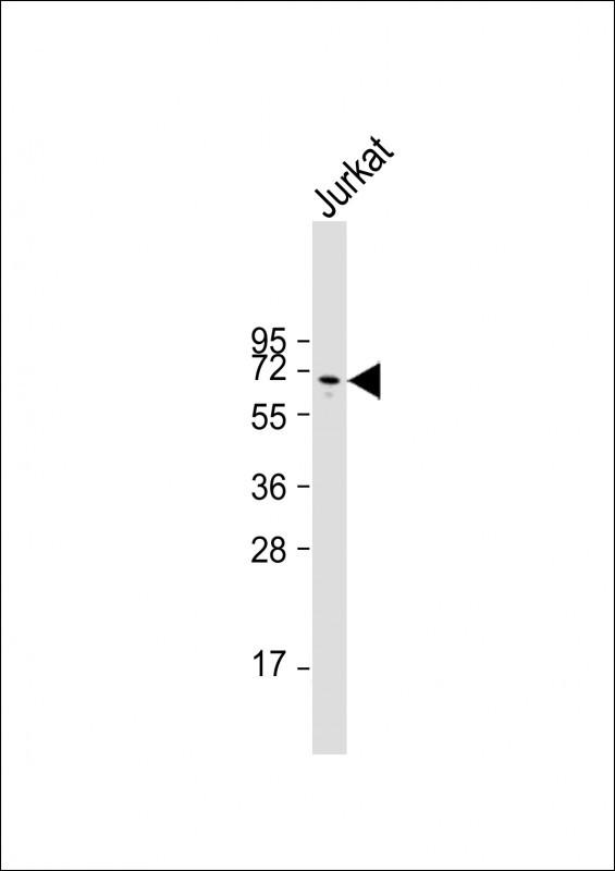 Anti-GPC3 Antibody (C35) at 1:2000 dilution + Jurkat whole cell lysateLysates/proteins at 20 �g per lane. SecondaryGoat Anti-Rabbit IgG,  (H+L), Peroxidase conjugated at 1/10000 dilution. Predicted band size : 66 kDaBlocking/Dilution buffer: 5% NFDM/TBST.