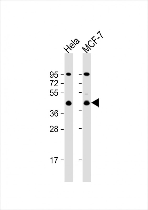 All lanes : Anti-ACTR2 Antibody (C-term) at 1:1000 dilutionLane 1: Hela whole cell lysateLane 2: MCF-7 whole cell lysateLysates/proteins at 20 �g per lane. SecondaryGoat Anti-Rabbit IgG,  (H+L), Peroxidase conjugated at 1/10000 dilution. Predicted band size : 45 kDaBlocking/Dilution buffer: 5% NFDM/TBST.