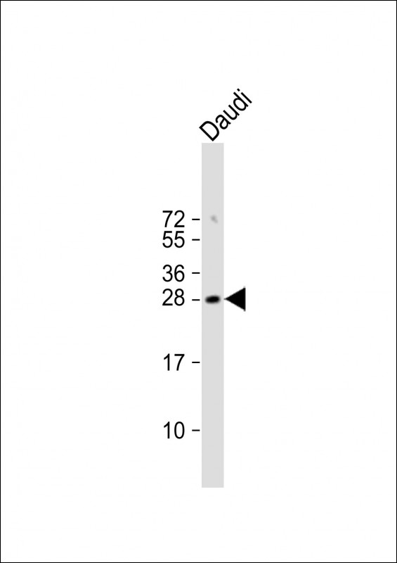 Anti-FAM3B Antibody (N-term) at 1:1000 dilution + Daudi whole cell lysateLysates/proteins at 20 �g per lane. SecondaryGoat Anti-Rabbit IgG,  (H+L), Peroxidase conjugated at 1/10000 dilution. Predicted band size : 26 kDaBlocking/Dilution buffer: 5% NFDM/TBST.