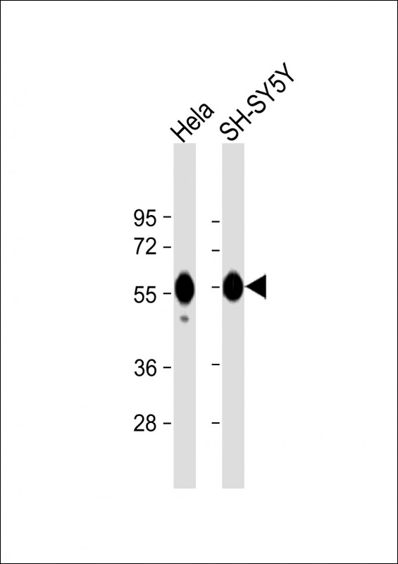 All lanes : Anti-CALR Antibody at 1:1000 dilutionLane 1: Hela whole cell lysateLane 2: SH-SY5Y whole cell lysateLysates/proteins at 20 �g per lane. SecondaryGoat Anti-Rabbit IgG,  (H+L), Peroxidase conjugated at 1/10000 dilution. Predicted band size : 48 kDaBlocking/Dilution buffer: 5% NFDM/TBST.