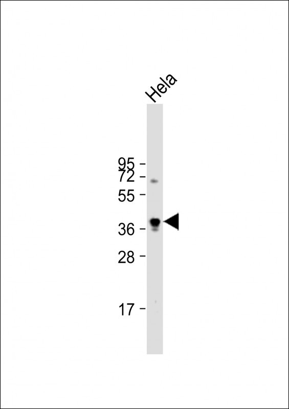 Anti-PKA-C-alpha/beta Antibody at 1:1000 dilution + Hela whole cell lysateLysates/proteins at 20 �g per lane.  SecondaryGoat Anti-Rabbit IgG,   (H+L),  Peroxidase conjugated at 1/10000 dilution.  Predicted band size : 41 kDaBlocking/Dilution buffer: 5% NFDM/TBST.