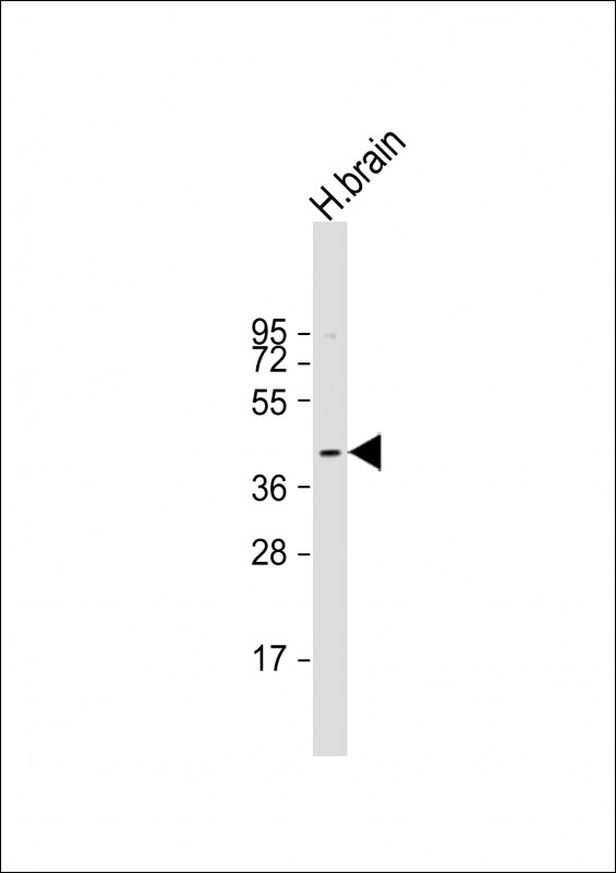 Anti-PRKACB Antibody (K29) at 1:1000 dilution + human brain lysateLysates/proteins at 20 �g per lane. SecondaryGoat Anti-Rabbit IgG,  (H+L), Peroxidase conjugated at 1/10000 dilution. Predicted band size : 41 kDaBlocking/Dilution buffer: 5% NFDM/TBST.