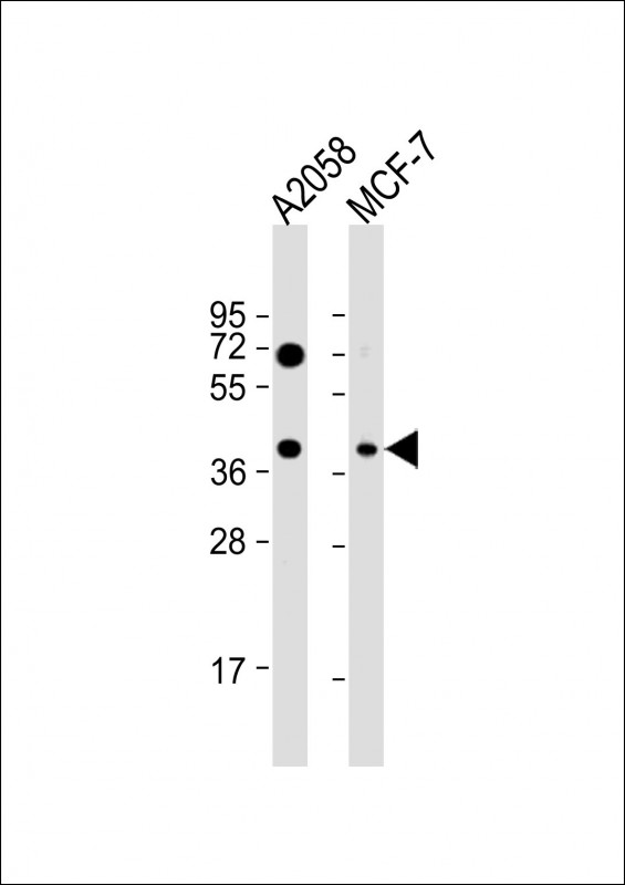WB - GNA12 Antibody (S67) AP8035a