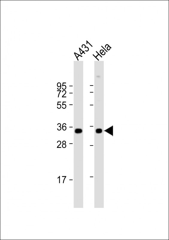All lanes : Anti-PPP2CA/B Antibody (F289) at 1:1000 dilutionLane 1: A431 whole cell lysateLane 2: Hela whole cell lysateLysates/proteins at 20 �g per lane. SecondaryGoat Anti-Rabbit IgG,  (H+L), Peroxidase conjugated at 1/10000 dilution. Predicted band size : 36 kDaBlocking/Dilution buffer: 5% NFDM/TBST.