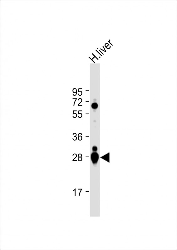 Anti-GSTA2 Antibody (N-term) at 1:1000 dilution + human liver lysateLysates/proteins at 20 �g per lane. SecondaryGoat Anti-Rabbit IgG,  (H+L), Peroxidase conjugated at 1/10000 dilution. Predicted band size : 26 kDaBlocking/Dilution buffer: 5% NFDM/TBST.
