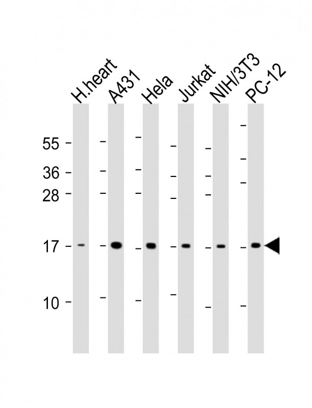 WB - UBC9 Antibody AM1261a