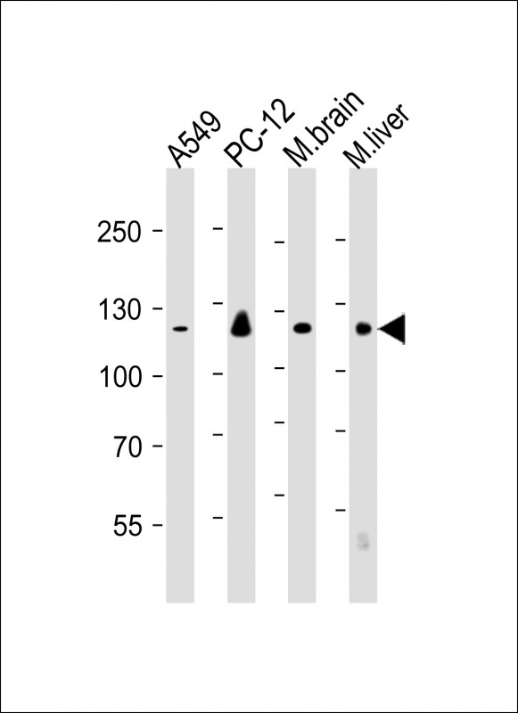 All lanes : Anti-EIF2AK3 Antibody at 1:250-1:1000 dilutionLane 1: A549 whole cell lysateLane 2: PC-12 whole cell lysateLane 3: mouse brain lysateLane 4: mouse liver lysateLysates/proteins at 20 �g per lane. SecondaryGoat Anti-mouse IgG,  (H+L), Peroxidase conjugated at 1/10000 dilution. Predicted band size : 125 kDaBlocking/Dilution buffer: 5% NFDM/TBST.