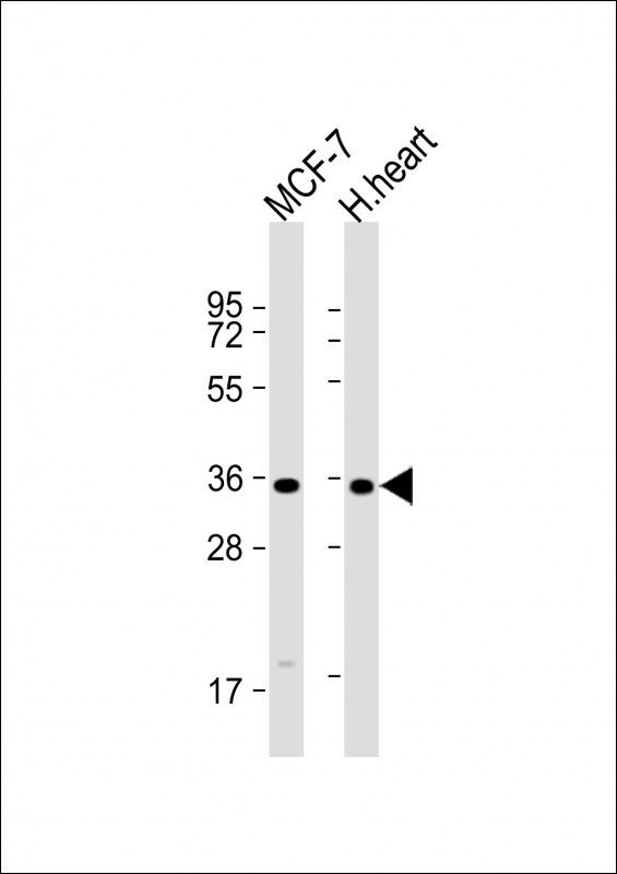 All lanes : Anti-GPD1L Antibody (N-term) at 1:1000 dilutionLane 1: MCF-7 whole cell lysateLane 2: human heart lysateLysates/proteins at 20 �g per lane. SecondaryGoat Anti-Rabbit IgG,  (H+L), Peroxidase conjugated at 1/10000 dilution. Predicted band size : 38 kDaBlocking/Dilution buffer: 5% NFDM/TBST.