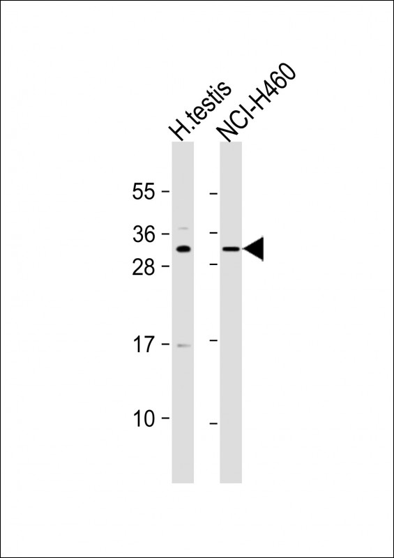 WB - SPMIP9 Antibody (Center) AP11056c