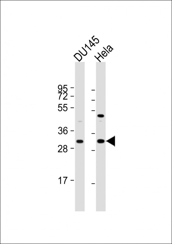 All lanes : Anti-NTHL1 Antibody (Center R103) at 1:1000 dilutionLane 1: DU145 whole cell lysateLane 2: Hela whole cell lysateLysates/proteins at 20 �g per lane. SecondaryGoat Anti-Rabbit IgG,  (H+L), Peroxidase conjugated at 1/10000 dilution. Predicted band size : 34 kDaBlocking/Dilution buffer: 5% NFDM/TBST.