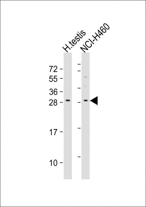 WB - LCN9 Antibody (N-term) AP11727a