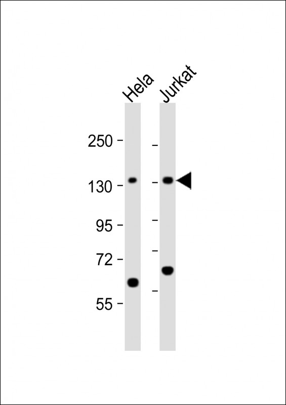 All lanes : Anti-SF3B3 Antibody (C-term) at 1:1000 dilutionLane 1: Hela whole cell lysateLane 2: Jurkat whole cell lysateLysates/proteins at 20 �g per lane. SecondaryGoat Anti-Rabbit IgG,  (H+L), Peroxidase conjugated at 1/10000 dilution. Predicted band size : 136 kDaBlocking/Dilution buffer: 5% NFDM/TBST.