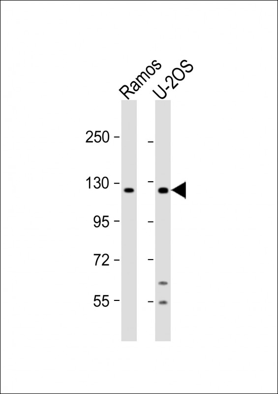 WB - UBN2 Antibody (N-term) AP13523a