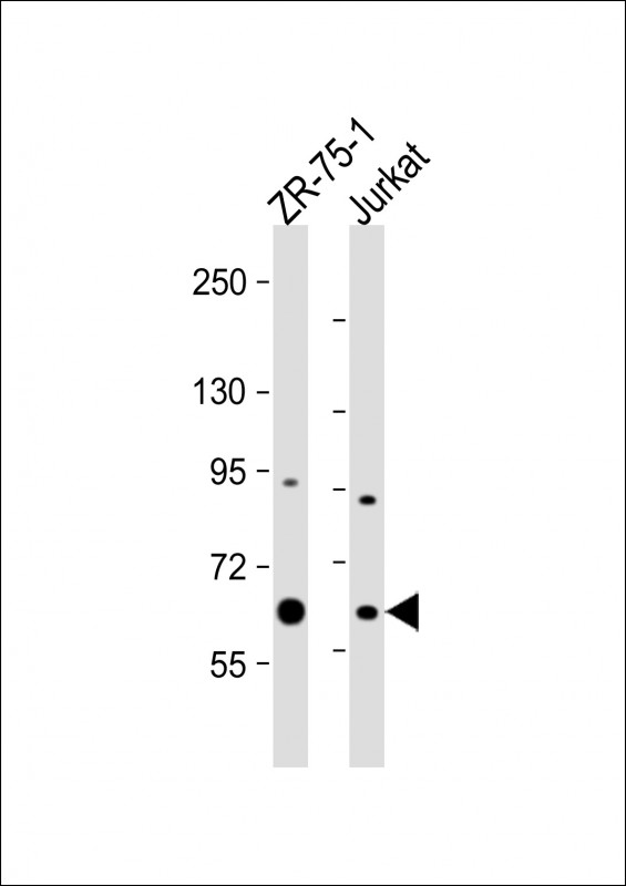 All lanes : Anti-PPM1D Antibody (Center) at 1:1000 dilutionLane 1: ZR-75-1 whole cell lysateLane 2: Jurkat whole cell lysateLysates/proteins at 20 �g per lane.  SecondaryGoat Anti-Rabbit IgG,   (H+L),  Peroxidase conjugated at 1/10000 dilution.  Predicted band size : 67 kDaBlocking/Dilution buffer: 5% NFDM/TBST.