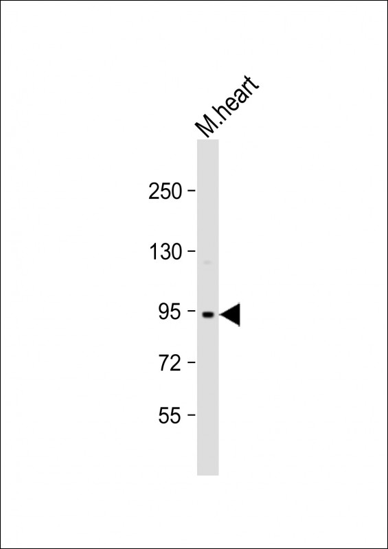 WB - Mouse TRPV3 Antibody (N-term) AP1425a