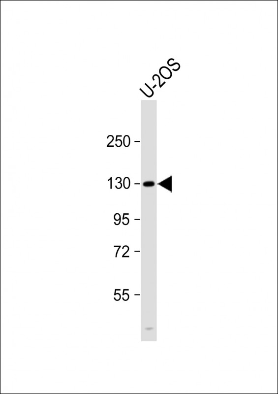 Anti-DNMT3A Antibody (R478WMutant) at 1:1000 dilution + U-2OS whole cell lysateLysates/proteins at 20 �g per lane. SecondaryGoat Anti-Rabbit IgG,  (H+L), Peroxidase conjugated at 1/10000 dilution. Predicted band size : 102 kDaBlocking/Dilution buffer: 5% NFDM/TBST.