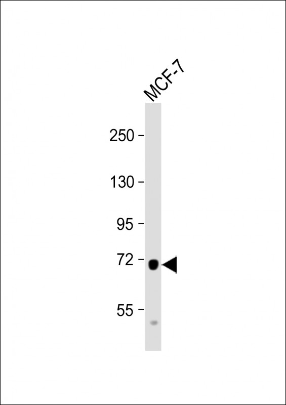 Anti-PDZK1 Antibody (Center) at 1:1000 dilution + MCF-7 whole cell lysateLysates/proteins at 20 �g per lane. SecondaryGoat Anti-Rabbit IgG,  (H+L), Peroxidase conjugated at 1/10000 dilution. Predicted band size : 57 kDaBlocking/Dilution buffer: 5% NFDM/TBST.