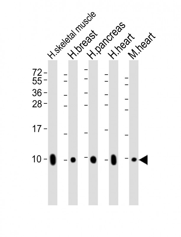 WB - COX7A1 Antibody (Center) AP16006c