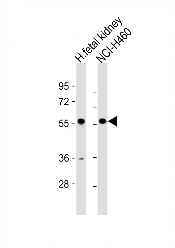 WB - XKRX Antibody (C-term) AP16779b