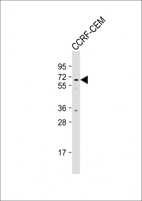 WB - MSL2 Antibody (N-term) AP17353a