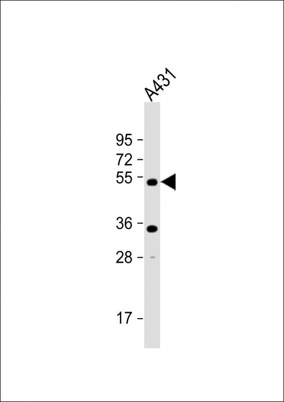 Anti-ATG4D  Antibody (C-term) at 1:1000 dilution + A431 whole cell lysateLysates/proteins at 20 �g per lane. SecondaryGoat Anti-Rabbit IgG,  (H+L), Peroxidase conjugated at 1/10000 dilution. Predicted band size : 53 kDaBlocking/Dilution buffer: 5% NFDM/TBST.