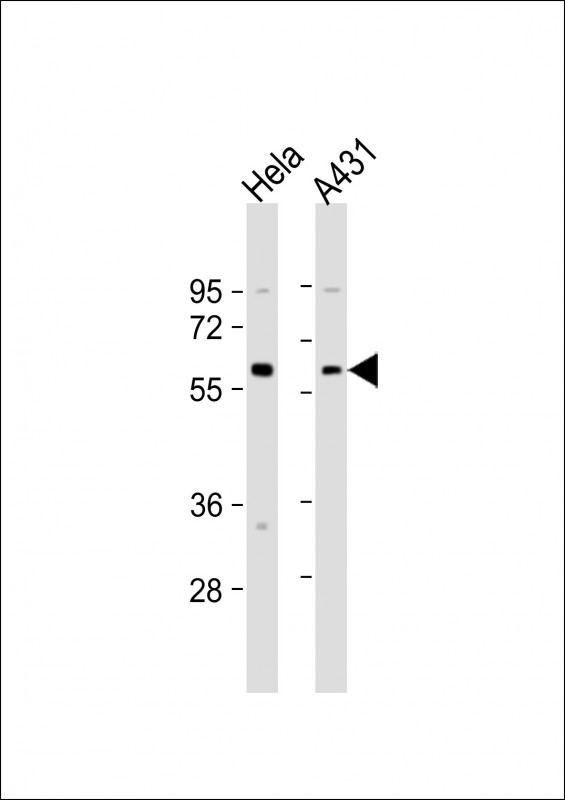 All lanes : Anti-Beclin-1 Antibody  (E225) at 1:4000 dilutionLane 1: Hela whole cell lysateLane 2: A431 whole cell lysateLysates/proteins at 20 �g per lane. SecondaryGoat Anti-Rabbit IgG,  (H+L), Peroxidase conjugated at 1/10000 dilution. Predicted band size : 52 kDaBlocking/Dilution buffer: 5% NFDM/TBST.