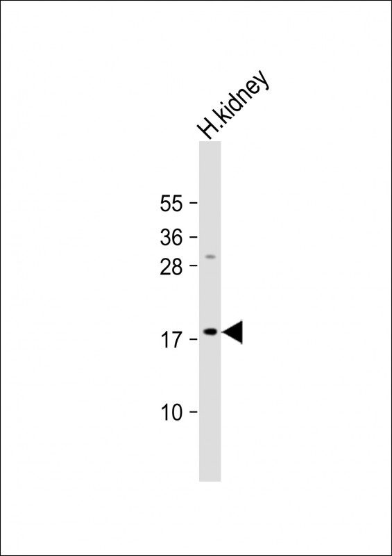 WB - LYZL1 Antibody (C-term) AP18526b