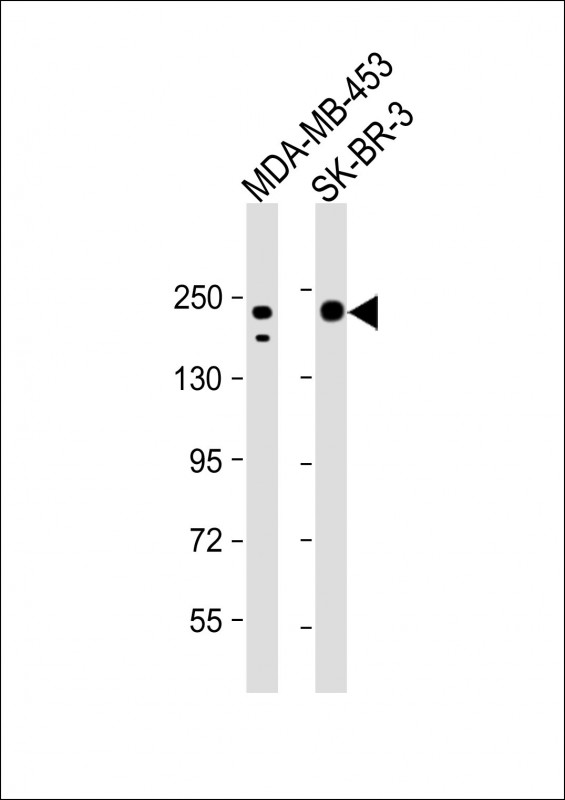 All lanes : Anti-ERBB2 Antibody (S1151) at 1:1000 dilutionLane 1: MDA-MB-453 whole cell lysateLane 2: SK-BR-3 whole cell lysateLysates/proteins at 20 �g per lane. SecondaryGoat Anti-Rabbit IgG,  (H+L), Peroxidase conjugated at 1/10000 dilution. Predicted band size : 138 kDaBlocking/Dilution buffer: 5% NFDM/TBST.