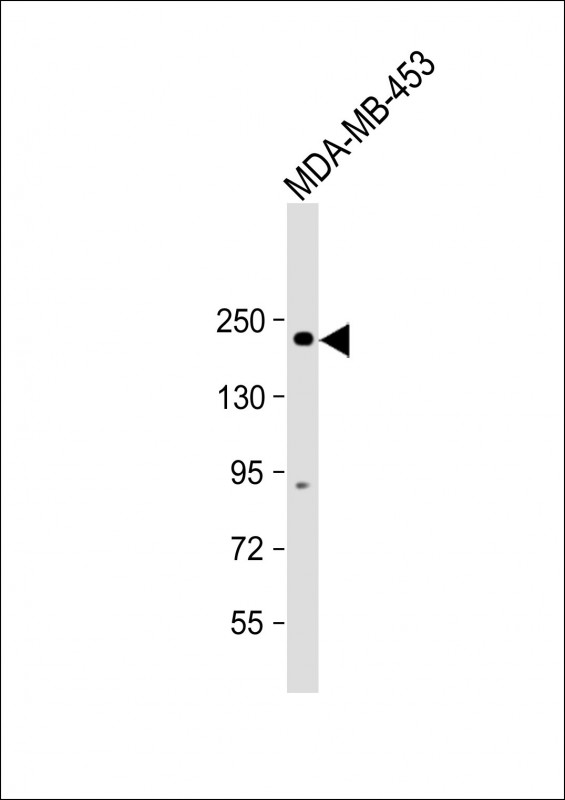 Anti ERBB2 Antibody (Y1127) at 1:1000 dilution + MDA-MB-453 whole cell lysateLysates/proteins at 20 �g per lane. SecondaryGoat Anti-Rabbit IgG,  (H+L), Peroxidase conjugated at 1/10000 dilution. Predicted band size : 138 kDaBlocking/Dilution buffer: 5% NFDM/TBST.