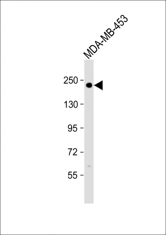 Anti ERBB2 Antibody (S728) at 1:500 dilution + MDA-MB-453 whole cell lysateLysates/proteins at 20 �g per lane. SecondaryGoat Anti-Rabbit IgG,  (H+L), Peroxidase conjugated at 1/10000 dilution. Predicted band size : 138 kDaBlocking/Dilution buffer: 5% NFDM/TBST.