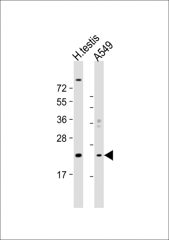 WB - HSPB9 Antibody (Center) AP19067c