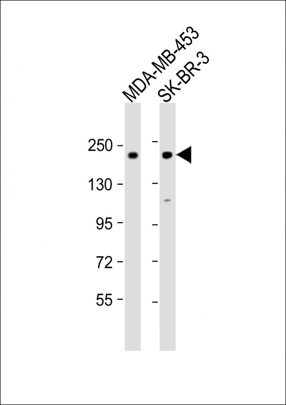 All lanes : Anti-ERBB2 Antibody (S998) at 1:1000 dilutionLane 1: MDA-MB-453 whole cell lysateLane 2: SK-BR-3 whole cell lysateLysates/proteins at 20 �g per lane. SecondaryGoat Anti-Rabbit IgG,  (H+L), Peroxidase conjugated at 1/10000 dilution. Predicted band size : 138 kDaBlocking/Dilution buffer: 5% NFDM/TBST.