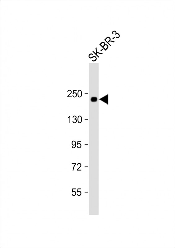 Anti-ERBB2 Antibody (Y1196) at 1:1000 dilution + SK-BR-3 whole cell lysateLysates/proteins at 20 �g per lane. SecondaryGoat Anti-Rabbit IgG,  (H+L), Peroxidase conjugated at 1/10000 dilution. Predicted band size : 138 kDaBlocking/Dilution buffer: 5% NFDM/TBST.