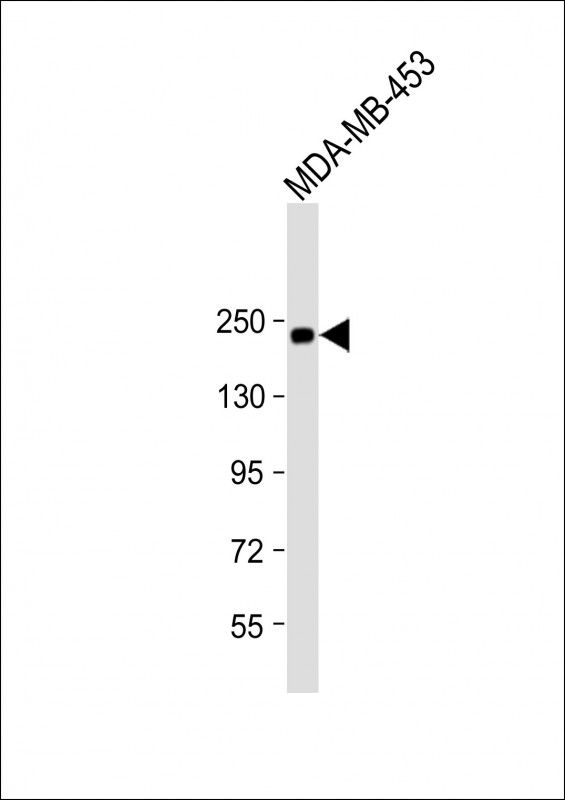 Anti-ERBB2 Antibody (Y877) at 1:500 dilution + MDA-MB-453 whole cell lysateLysates/proteins at 20 �g per lane. SecondaryGoat Anti-Rabbit IgG,  (H+L), Peroxidase conjugated at 1/10000 dilution. Predicted band size : 138 kDaBlocking/Dilution buffer: 5% NFDM/TBST.