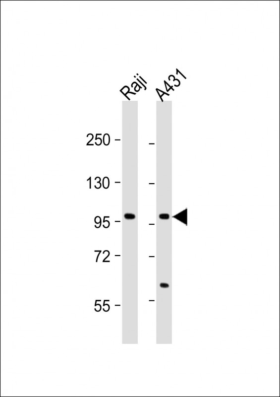 All lanes : Anti-NFKB1 Antibody (S932) at 1:1000 dilutionLane 1: Raji whole cell lysateLane 2: A431 whole cell lysateLysates/proteins at 20 �g per lane. SecondaryGoat Anti-Rabbit IgG,  (H+L), Peroxidase conjugated at 1/10000 dilution. Predicted band size : 105 kDaBlocking/Dilution buffer: 5% NFDM/TBST.