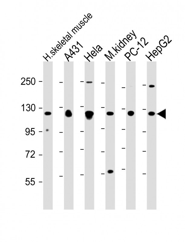 All lanes : Anti-Vinculin at 1:2000 dilutionLane 1: human skeletal muscle lysateLane 2: A431 whole cell lysateLane 3: Hela whole cell lysateLane 4: mouse kidney lysateLane 5: PC-12 whole cell lysateLane 6: HepG2 whole cell lysateLysates/proteins at 20 �g per lane. SecondaryGoat Anti-Rabbit IgG,  (H+L), Peroxidase conjugated at 1/10000 dilution. Predicted band size : 117 kDaBlocking/Dilution buffer: 5% NFDM/TBST.