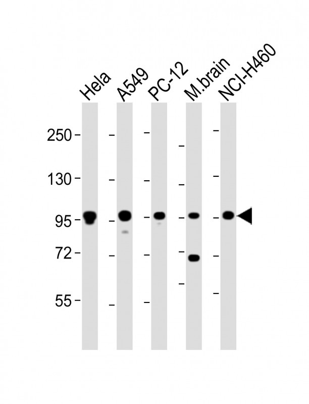 All lanes : Anti-PCSK1 Antibody (C-Term) at 1:2000 dilutionLane 1: Hela whole cell lysateLane 2: A549 whole cell lysateLane 3: PC-12 whole cell lysateLane 4: mouse brain lysateLane 5: NCI-H460 whole cell lysateLysates/proteins at 20 �g per lane. SecondaryGoat Anti-Rabbit IgG,  (H+L), Peroxidase conjugated at 1/10000 dilution. Predicted band size : 84 kDaBlocking/Dilution buffer: 5% NFDM/TBST.