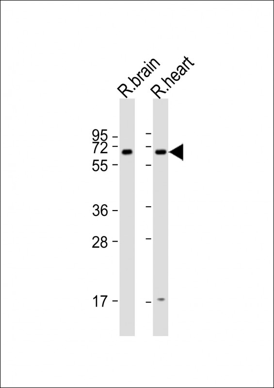 All lanes : Anti-Collybistin(Arhgef9) (Center) at 1:1000 dilutionLane 1: rat brain lysateLane 2: rat heart lysateLysates/proteins at 20 �g per lane. SecondaryGoat Anti-Rabbit IgG,  (H+L), Peroxidase conjugated at 1/10000 dilution. Predicted band size : 58 kDaBlocking/Dilution buffer: 5% NFDM/TBST.