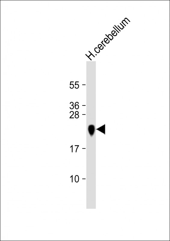 Anti MBP Antibody (Y203) at 1:16000 dilution + human cerebellum lysateLysates/proteins at 20 �g per lane. SecondaryGoat Anti-Rabbit IgG,  (H+L), Peroxidase conjugated at 1/10000 dilution. Predicted band size : 33 kDaBlocking/Dilution buffer: 5% NFDM/TBST.