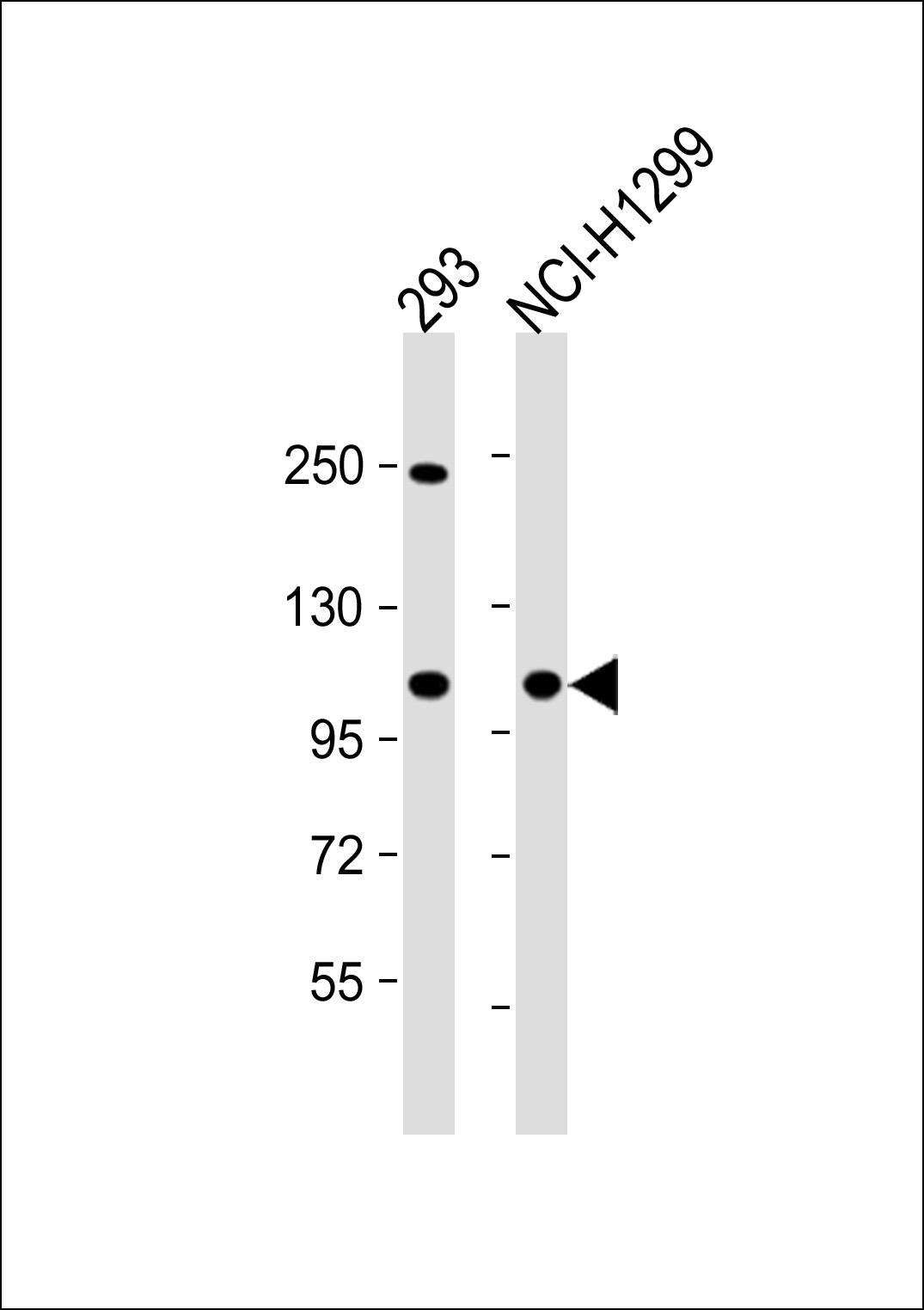 All lanes : Anti-CTDP1 Antibody (N-term) at 1:1000 dilutionLane 1: 293 whole cell lysateLane 2: NCI-H1299 whole cell lysateLysates/proteins at 20 �g per lane. SecondaryGoat Anti-Rabbit IgG,  (H+L), Peroxidase conjugated at 1/10000 dilution. Predicted band size : 104 kDaBlocking/Dilution buffer: 5% NFDM/TBST.